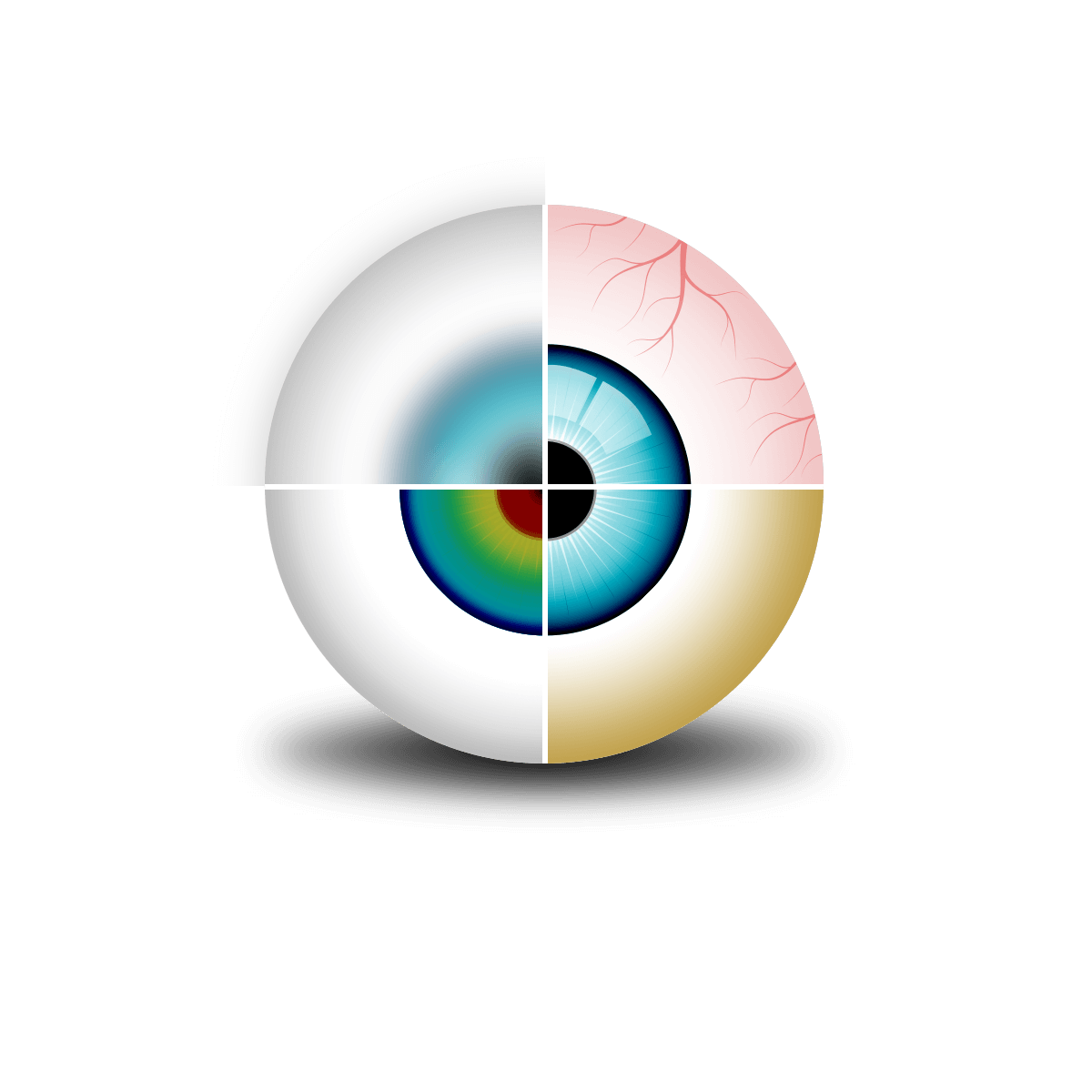 Image of drawn eye with four quadarants with problems listed below